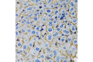 Immunohistochemistry of paraffin-embedded rat liver using RAF1 antibody. (RAF1 antibody)