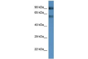 WB Suggested Anti-Slc6a15 Antibody   Titration: 1. (SLC6A15 antibody  (Middle Region))