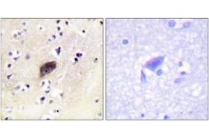 Immunohistochemistry analysis of paraffin-embedded human brain, using PAK1/2/3 (Phospho-Ser144/141/139) Antibody. (PAK1/2/3 antibody  (pSer144))