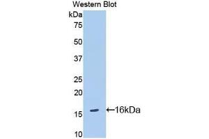 Detection of Recombinant IL18R1, Mouse using Polyclonal Antibody to Interleukin 18 Receptor 1 (IL18R1) (IL18R1 antibody  (AA 391-518))