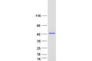 Validation with Western Blot
