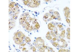 Immunohistochemistry of paraffin-embedded Human stomach using PIP4K2B Polyclonal Antibody at dilution of 1:100 (40x lens). (PIP4K2B antibody)