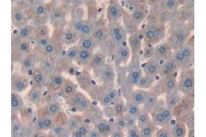Glypican 3 antibody  (AA 344-559)