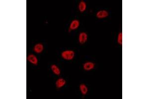ABIN6274686 staining A549 by IF/ICC. (Exonuclease 1 antibody  (N-Term))