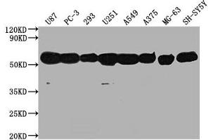 Western Blot Positive WB detected in: U87 whole cell lysate, PC-3 whole cell lysate, 293 whole cell lysate, U251 whole cell lysate, A549 whole cell lysate, A375 whole cell lysate, MG-63 whole cell lysate, SH-SY5Y whole cell lysate, All lanes: TUBA1A antibody at 1:5000 Secondary Goat polyclonal to Mouse IgG at 1/10000 dilution Predicted band size: 52 kDa Observed band size: 52 kDa (TUBA1A antibody)
