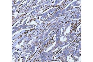 IHC analysis of Hsp47/SERPINH1 using anti-Hsp47/SERPINH1 antibody (ABIN3043331). (SERPINH1 antibody  (AA 247-418))