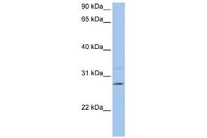 PEMT antibody used at 1 ug/ml to detect target protein. (PEMT antibody  (C-Term))