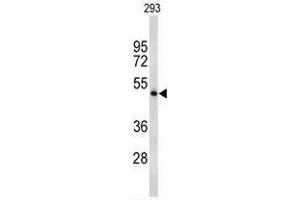 Western blot analysis of TPH2 Antibody (Center) in 293 cell line lysates (35 µg/lane). (Tryptophan Hydroxylase 2 antibody  (Middle Region))