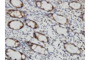 Immunoperoxidase of monoclonal antibody to RALB on formalin-fixed paraffin-embedded human colon. (RALB antibody  (AA 89-183))