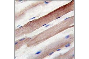 Formalin-fixed and paraffin-embedded human skeletal muscle reacted with Autophagy AAPG4B / ATG4B Antibody , which was peroxidase-conjugated to the secondary antibody, followed by DAB staining. (ATG4B antibody  (AA 264-293))