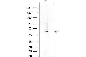 anti-serpin Peptidase Inhibitor, Clade B (Ovalbumin), Member 7 (SERPINB7) (Internal Region) antibody