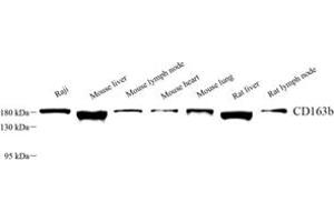 Western blot analysis of CD163b (ABIN7073371) at dilution of 1: 1000 (CD163L1 antibody)