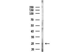 anti-Glutathione S-Transferase mu 4 (GSTM4) (Internal Region) antibody