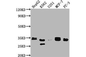 Western Blot Positive WB detected in: HepG2 whole cell lysate, K562 whole cell lysate, U251 whole cell lysate, MCF-7 whole cell lysate, PC-3 whole cell lysate All lanes: RPIA antibody at 1:2000 Secondary Goat polyclonal to rabbit IgG at 1/50000 dilution Predicted band size: 34 kDa Observed band size: 33 kDa (Ribose 5-Phosphate Isomerase A (RPIA) (AA 1-311) antibody)