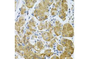 Immunohistochemistry of paraffin-embedded human stomach using PLCG1 Antibody. (Phospholipase C gamma 1 antibody)