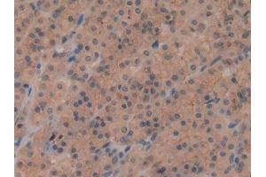Immunohistochemistry (IHC) image for anti-Sirtuin 2 (SIRT2) (AA 28-303) antibody (ABIN7436966)