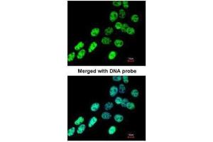 ICC/IF Image Immunofluorescence analysis of paraformaldehyde-fixed A431, using hnRNP F , antibody at 1:200 dilution. (HNRNPF antibody)