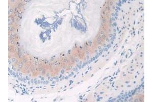 Used in DAB staining on fromalin fixed paraffin- embedded esophagus tissue (CFP antibody  (AA 54-217))
