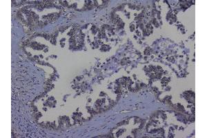 IHC analysis of NRF1 using anti-NRF1 antibody (ABIN6719347).