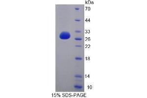 Image no. 1 for Cell Division Cycle 27 Homolog (S. Cerevisiae) (CDC27) (AA 17-231) protein (T7 tag,His tag) (ABIN6239558) (CDC27 Protein (AA 17-231) (T7 tag,His tag))