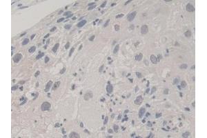 Immunohistochemistry (IHC) image for anti-Ubiquitin A-52 Residue Ribosomal Protein Fusion Product 1 (UBA52) (AA 1-128) antibody (ABIN7441190)