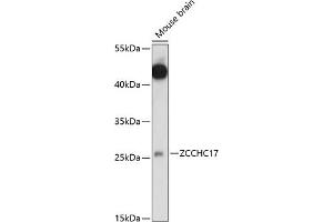 Western blot analysis of extracts of mouse brain, using ZCCHC17 antibody (ABIN7271546) at 1:1000 dilution.