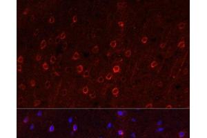 Immunofluorescence analysis of Rat brain using SLC1A1 Polyclonal Antibody at dilution of 1:100. (SLC1A1 antibody)