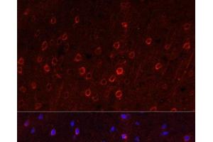 Immunofluorescence analysis of Rat brain using SLC1A1 Polyclonal Antibody at dilution of 1:100. (SLC1A1 antibody)