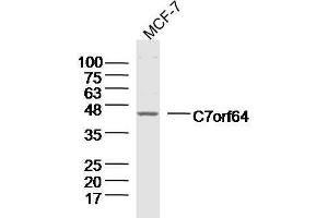 Lane 1: MCF-7 lysates probed with C7orf64 Polyclonal Antibody, Unconjugated  at 1:300 overnight at 4˚C.