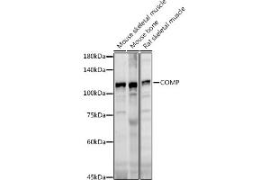 Western blot analysis of extracts of various cell lines, using COMP antibody (ABIN6127650, ABIN6138864, ABIN6138866 and ABIN6221502) at 1:1000 dilution. (COMP antibody  (AA 20-160))