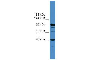 WB Suggested Anti-IFT88  Antibody Titration: 0. (IFT88 antibody  (Middle Region))