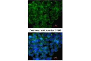 ICC/IF Image Immunofluorescence analysis of methanol-fixed mouse ESC, using IRF6, antibody at 1:100 dilution. (IRF6 antibody  (C-Term))