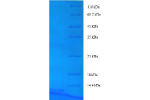 ATP-Binding Cassette, Sub-Family B (MDR/TAP), Member 1B (ABCB1B) (AA 236-297), (partial) protein (His tag)