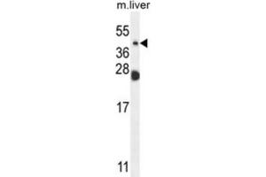 Western Blotting (WB) image for anti-Sialidase 4 (NEU4) antibody (ABIN2995626) (Sialidase 4 antibody)