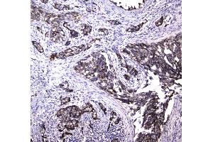 Immunohistochemistry (IHC) image for anti-MRE11 Meiotic Recombination 11 Homolog A (S. Cerevisiae) (MRE11A) (AA 2-239) antibody (ABIN5693272)