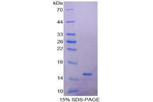SDS-PAGE (SDS) image for alpha Hemoglobin Stabilizing Protein (aHSP) (AA 2-102) protein (His tag) (ABIN2123985)