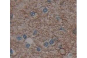 IHC-P analysis of Human Tissue, with DAB staining. (Metabotropic Glutamate Receptor 1 antibody  (AA 165-592))