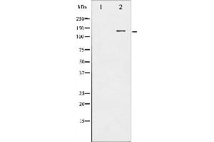 Western blot analysis of CBL phosphorylation expression in Na2VO3 treated HepG2 whole cell lysates,The lane on the left is treated with the antigen-specific peptide. (CBL antibody  (pTyr674))