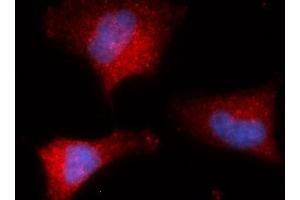 Immunofluorescence (IF) image for anti-Peptidylprolyl Isomerase G (Cyclophilin G) (PPIG) (AA 1-175) antibody (PE) (ABIN5567270) (PPIG antibody  (AA 1-175) (PE))