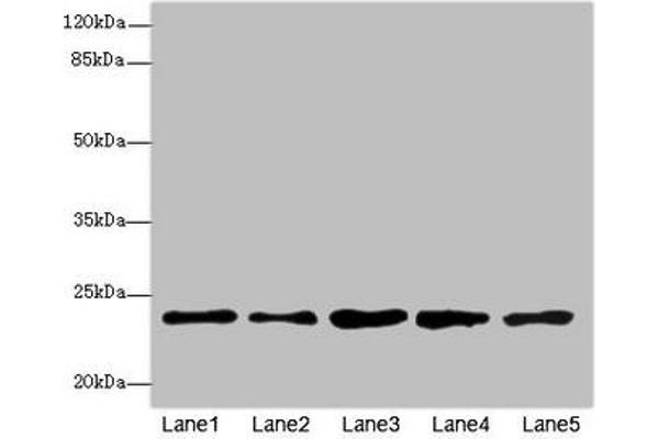 RAB9A antibody  (AA 122-201)