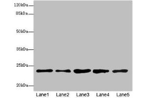 Western blot All lanes: RAB9A antibody at 7. (RAB9A antibody  (AA 122-201))