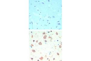 Image no. 1 for anti-K(lysine) Acetyltransferase 5 (KAT5) (AA 480-530) antibody (ABIN960242) (KAT5 antibody  (AA 480-530))