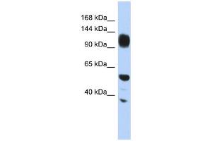 WB Suggested Anti-WDHD1 Antibody Titration: 0. (WDHD1 antibody  (Middle Region))