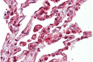 Anti-EIF4B antibody IHC staining of human lung. (EIF4B antibody  (AA 150-200))