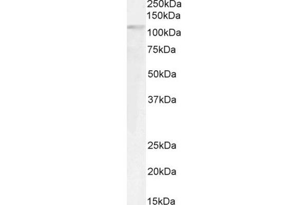 GTF2IRD1 antibody  (Internal Region)