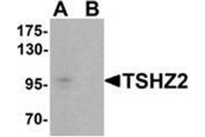 Western blot analysis of TSHZ2 in A-20 cell lysate with TSHZ2 Antibody  at 1 µg/ml in (A) the absence and (B) the presence of blocking peptide.