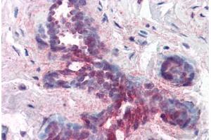 Human Breast (formalin-fixed, paraffin-embedded) stained with PDCD4 antibody ABIN214444 at 1. (PDCD4 antibody  (pSer457))