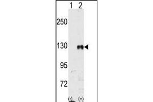 Western blot analysis of EphB1 (arrow) using rabbit polyclonal EphB1 Antibody (ABIN391918 and ABIN2841728) 293 cell lysates (2 μg/lane) either nontransfected (Lane 1) or transiently transfected with the EphB1 gene (Lane 2) (Origene Technologies). (EPH Receptor B1 antibody)