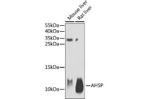 Western blot analysis of extracts of various cell lines, using AHSP antibody (ABIN6131912, ABIN6136672, ABIN6136673 and ABIN6222122) at 1:1000 dilution. (aHSP antibody  (AA 1-102))