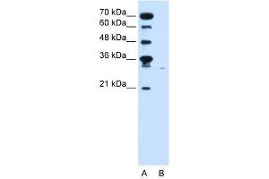 WB Suggested Anti-SLC22A7  Antibody Titration: 0. (SLC22A7 antibody  (C-Term))